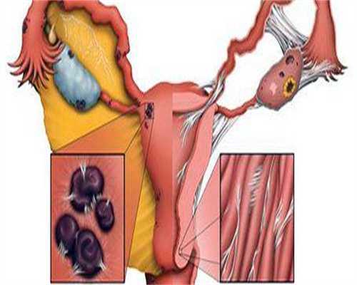 辽宁优质试管婴儿诊所推荐及三代技术解析
