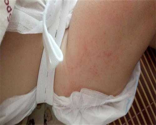 高龄女性如何备孕生二胎?