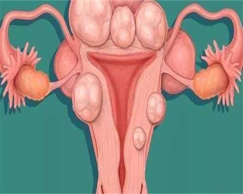 济南供卵试管方法，让爱更快实现