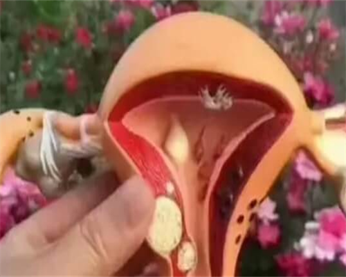 第三代试管婴儿的费用考量及助孕咨询