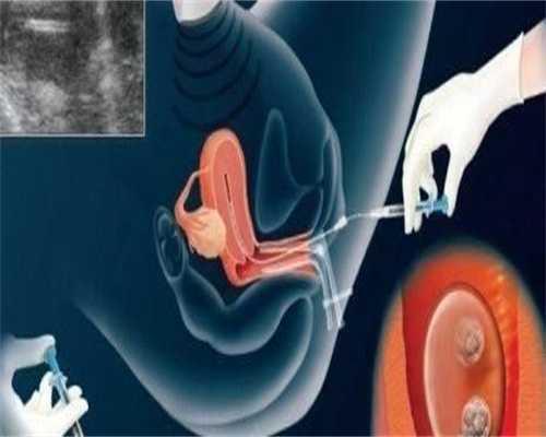 泰国供卵助孕机构!代生双胞胎在哪里